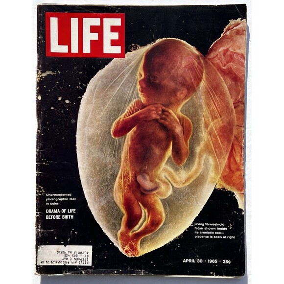 Other - LIFE Magazine April 30, 1965 Drama Of Life Before Birth Issue